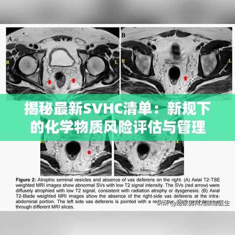 揭秘最新SVHC清单：新规下的化学物质风险评估与管理