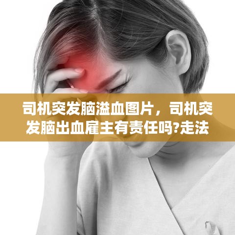 司机突发脑溢血图片,司机突发脑出血雇主有责任吗?走法律我要陪多少钱