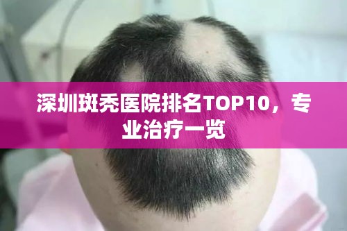 深圳斑秃医院排名TOP10，专业治疗一览